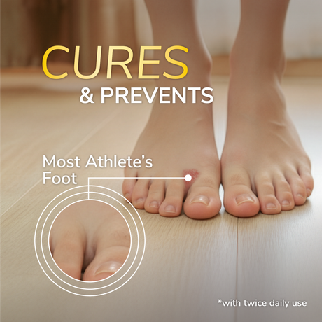 Athlete's Foot Antifungal Cream Treatment