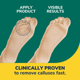 Callus Removers Seal & Heal Bandage with Hydrogel™ Technology