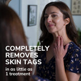 image of completely removes skin tags in as little as 1 treatment