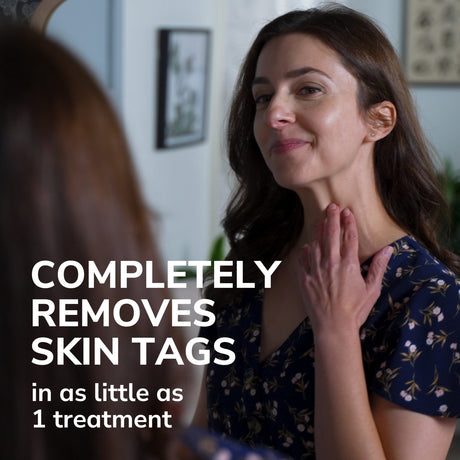 image of completely removes skin tags in as little as 1 treatment