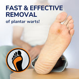 Plantar Wart Remover Gel