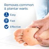 Freeze Away Max™ Wart Remover