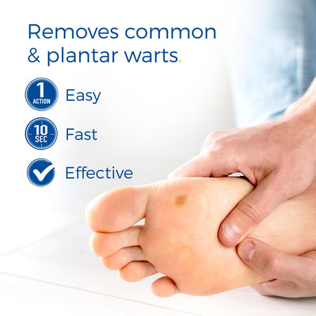 Freeze Away Max™ Wart Remover