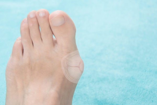 Image of a Bunion on Feet in a Soft Blue  Background.
