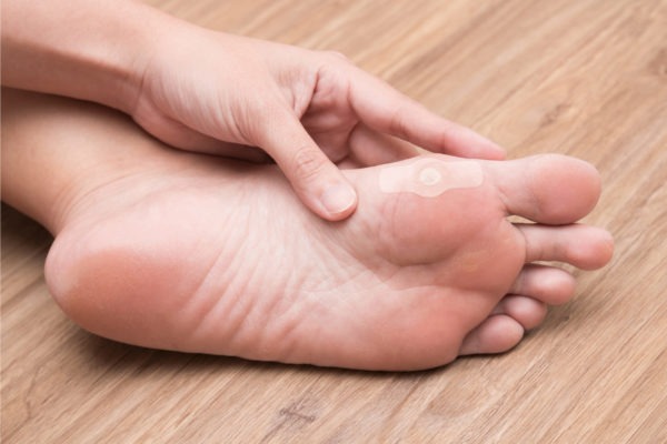 Image of a Person Wearing a Dr. Scholl's  Corn Remover on Foot.