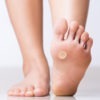 Image of Person's Foot Wearing a Dr.  Scholl's Corn Remover.