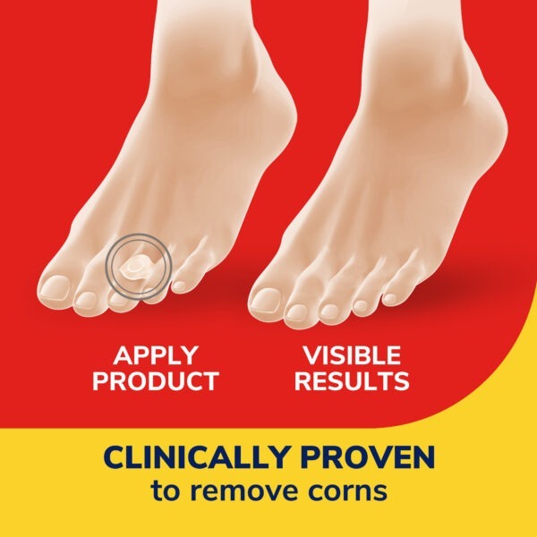 image of clinically proven to remove corns