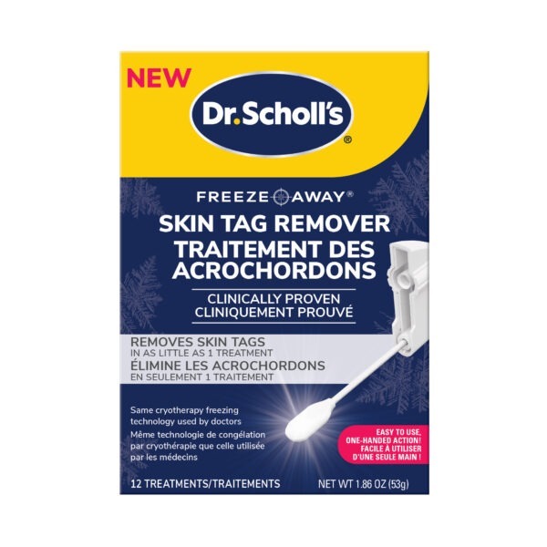 image of skin tag remover