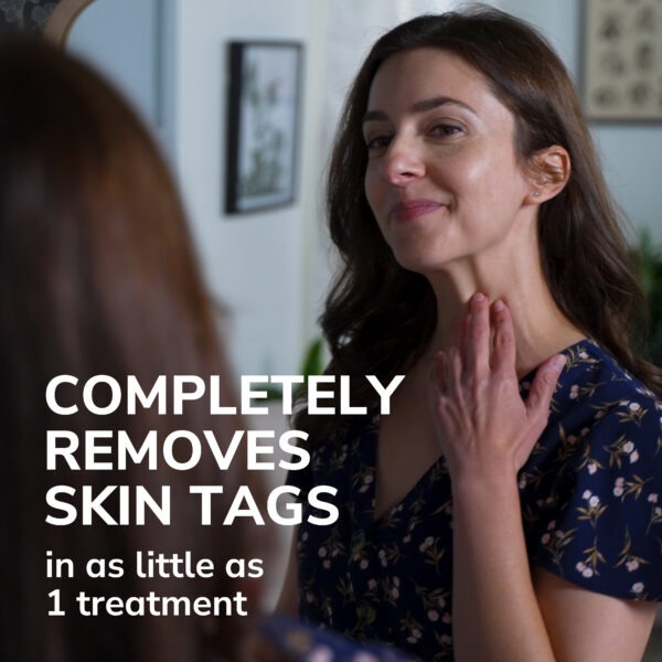 image of completely removes skin tags in as little as 1 treatment