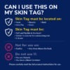 image of can i use this on my skin tag
