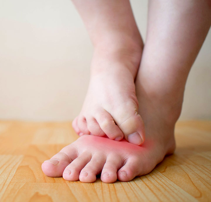 Students feet. Пятки мальчиков. Пятки детей девочек. Пятки детей 5 лет. Сыпь на стопах симметричная.