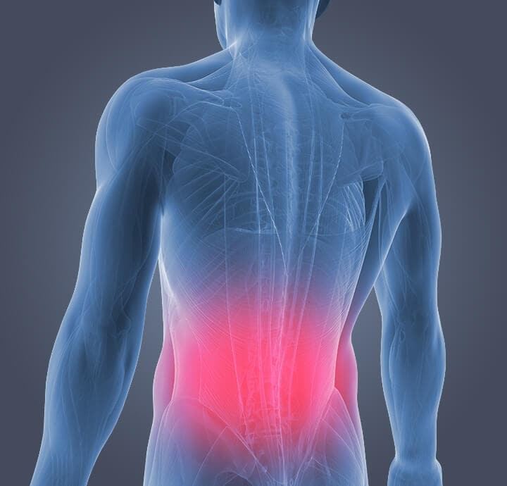 Image of a person demonstrating lower  back pain.