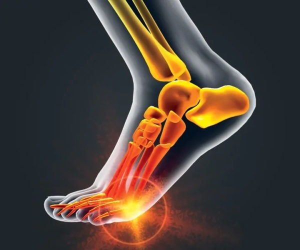 Pain Relief Orthotics for Ball of Foot Pain Dr. Scholl's