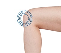 Image of a person with a bent knee with  knee circled. 