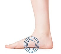Image of side of foot with arch pain  location circled. 