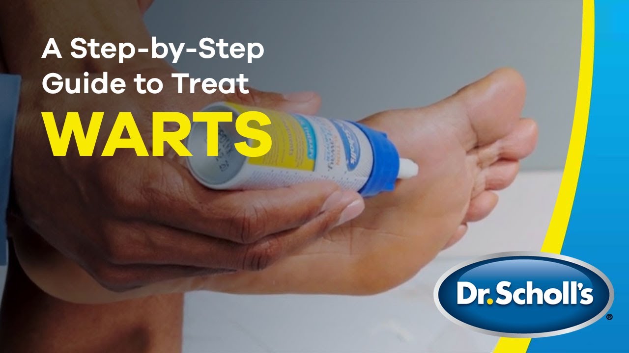 Freeze Away® Wart Remover For At Home Wart Removal Dr. Scholl's
