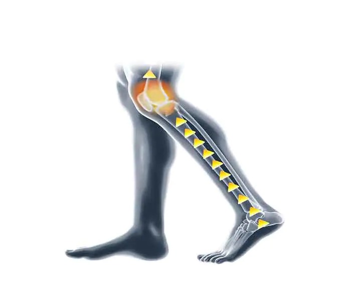 Image d'une personne souffrant de douleurs au genou