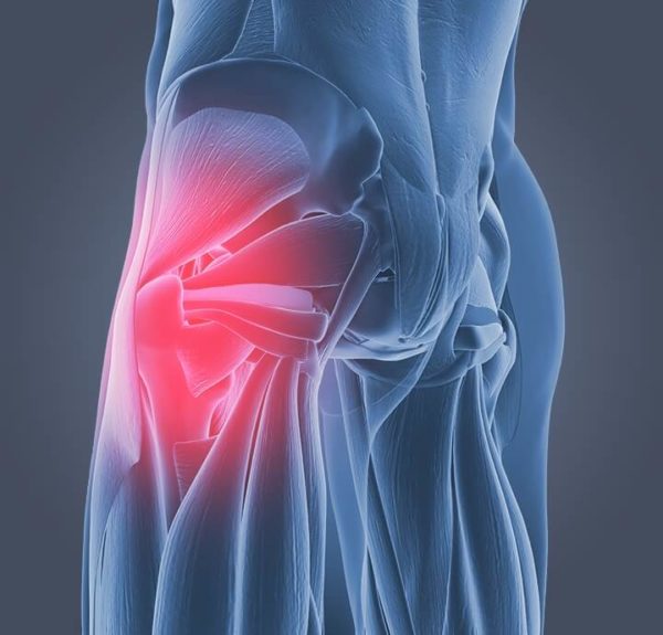 Comment soulager la douleur à la hanche  Dr. Scholl's